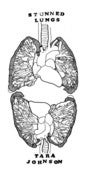 Image of Stunned Lungs