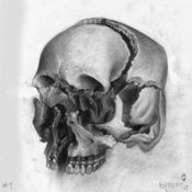 Image of Exploded skull study 1 
