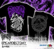 Image of EPICARDIECTOMY - Ulcerous Cadaveric Decrepitation TS - purple