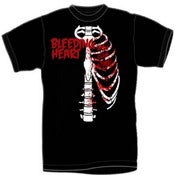 Image of ribcage