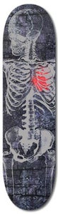 Image of Limited Edition Skateboard - Transplant