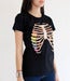Image of Xylobones