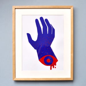 Image of Severed Hand