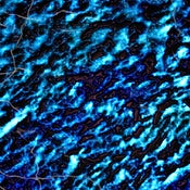 Image of Chemical Peel - PLACE mixtape