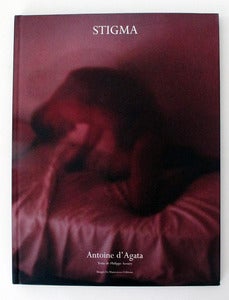 Image of Stigma by Antoine D'Agata 