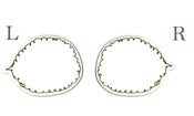 Image of Dry Wipe speech bubble wiggly