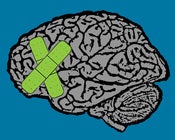 Image of migraine painting