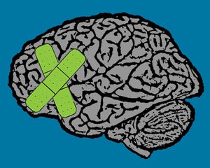 Image of migraine painting