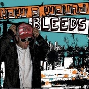 Image of How a Wound Bleeds