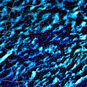 Image of Chemical Peel - PLACE mixtape (Digital Download)